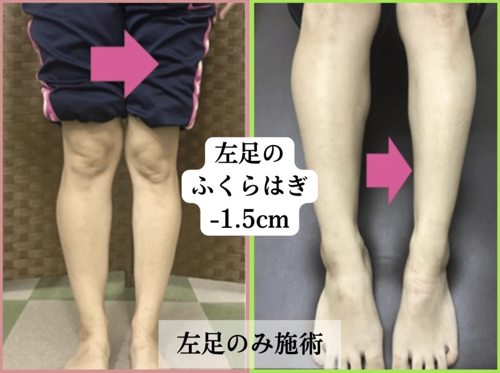 ビフォーアフターの写真です